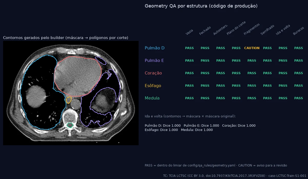 Corte axial de TC de tórax com contornos regenerados e tabela de checagens geométricas por estrutura, quase todas em PASS e uma em CAUTION.