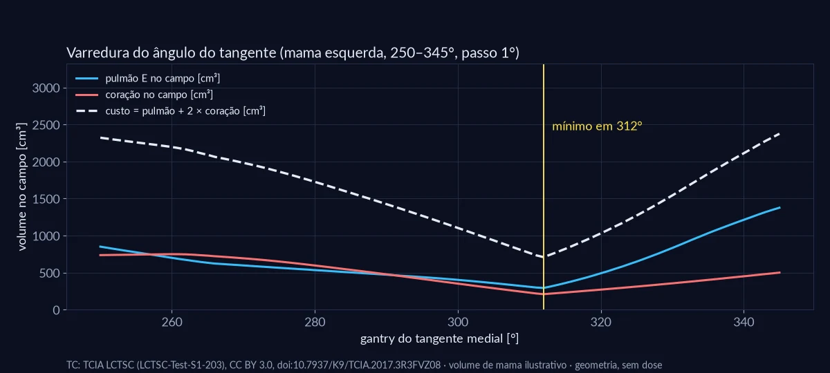 Volume de pulmão esquerdo e de coração dentro do campo em função do ângulo do tangente medial, com o custo e o mínimo em 312°