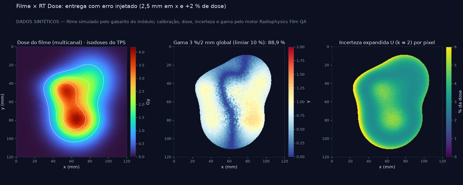 Três mapas lado a lado: dose do filme reconstruída pelo método multicanal com isodoses do TPS, mapa gama 3 %/2 mm com taxa de aprovação de 88,9 % e mapa da incerteza expandida por pixel.