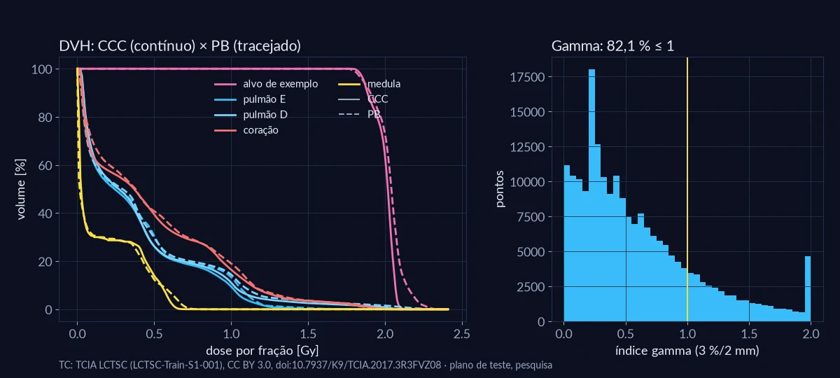DVH do alvo de exemplo, pulmões, coração e medula com os dois motores, e histograma do índice gamma