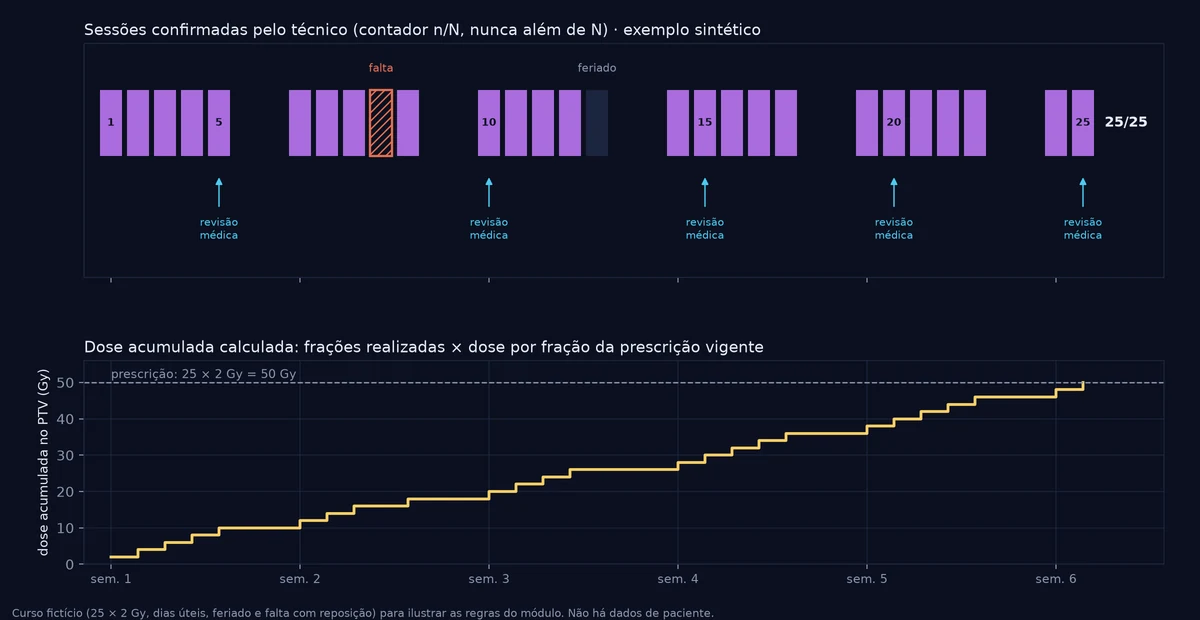 Linha do tempo de um curso fictício de 25 frações de 2 Gy em dias úteis, com uma falta, um feriado, revisão médica a cada 5 frações, contador 25/25 e curva em degraus da dose acumulada até 50 Gy.